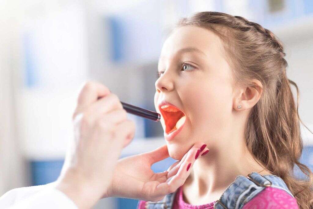 Tonsil Stones