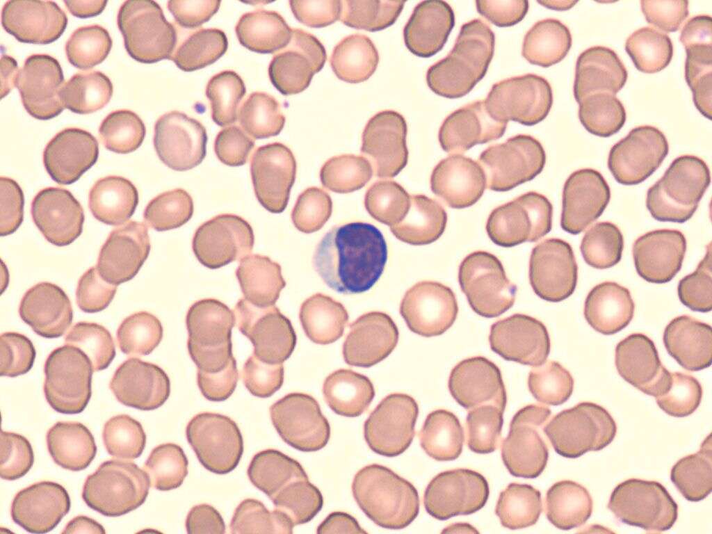 White Blood Cells