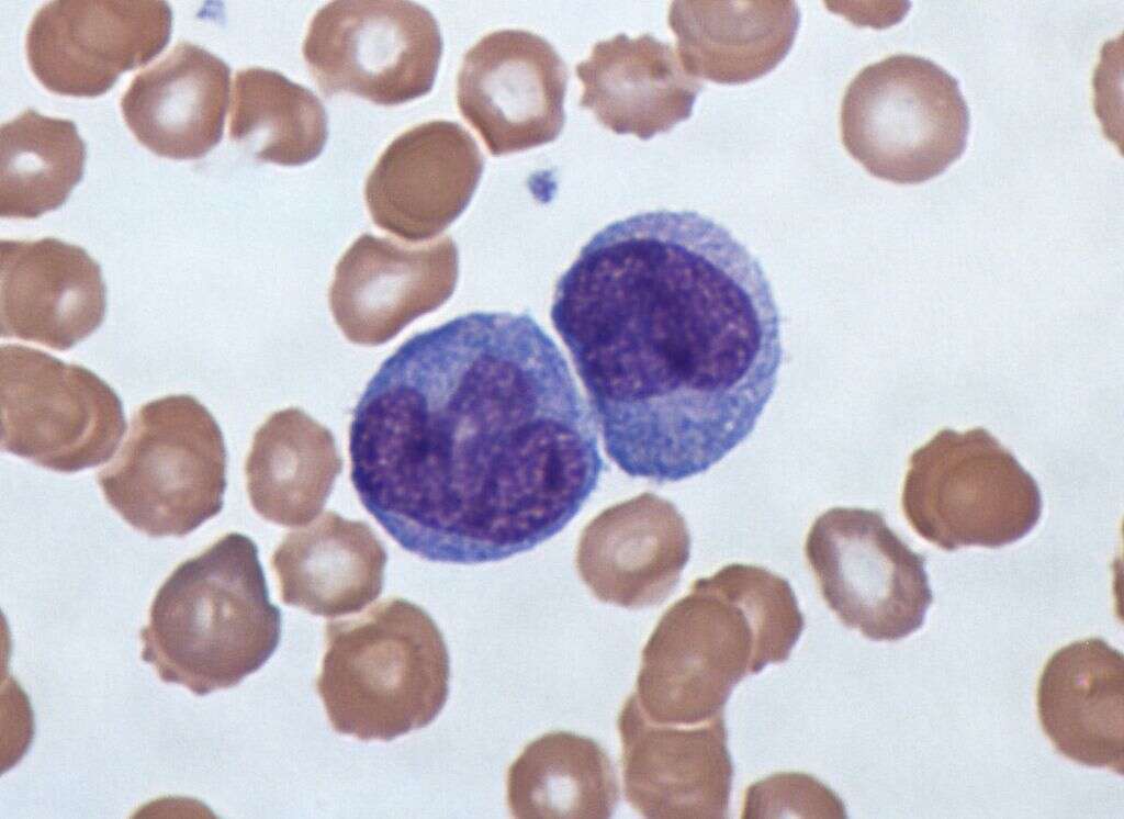 White Blood Cells