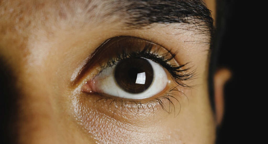 Bloodshot Eyes