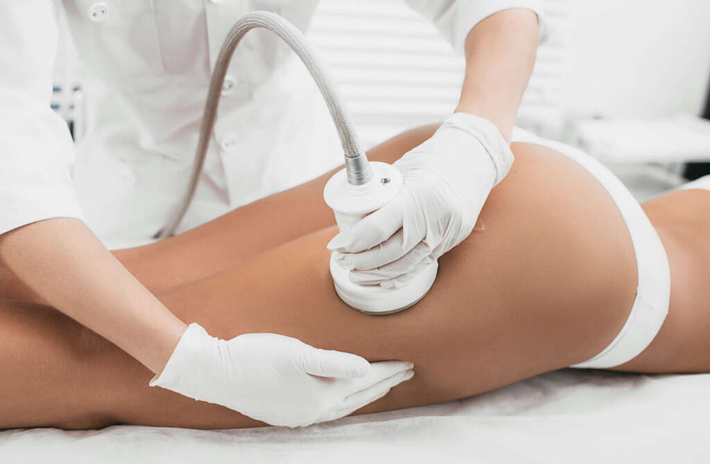 Cellulite