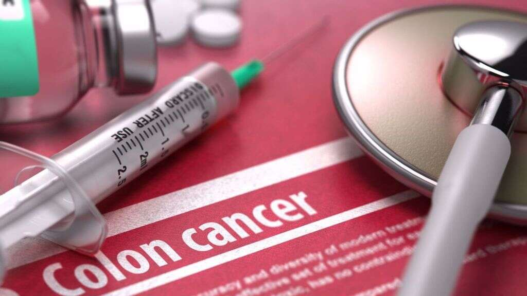 Colon Cancer