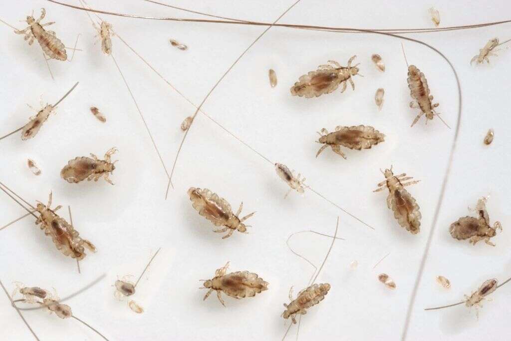 Head Lice