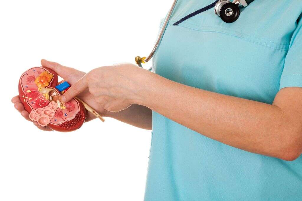 Kidney Stones
