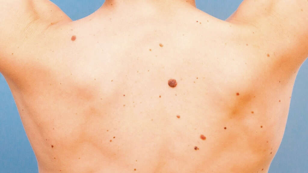 Moles