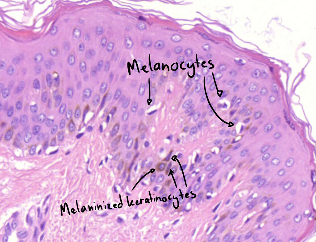 Moles