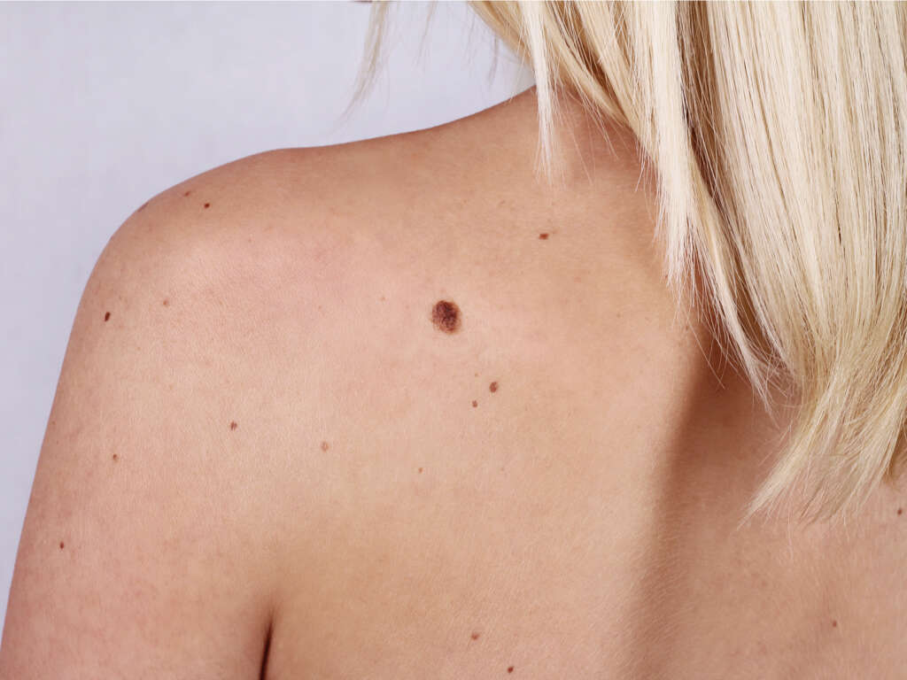 Moles