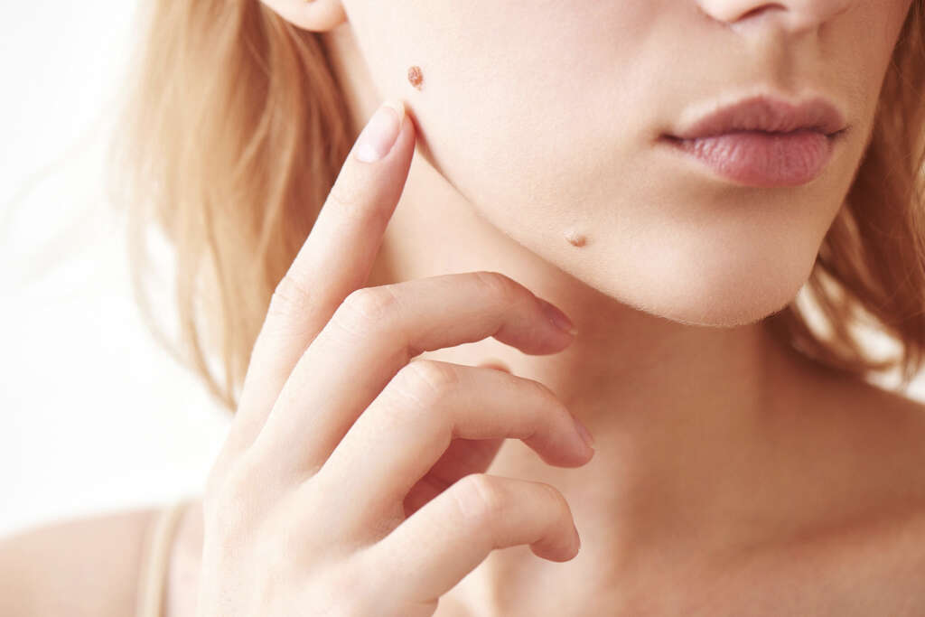 Moles