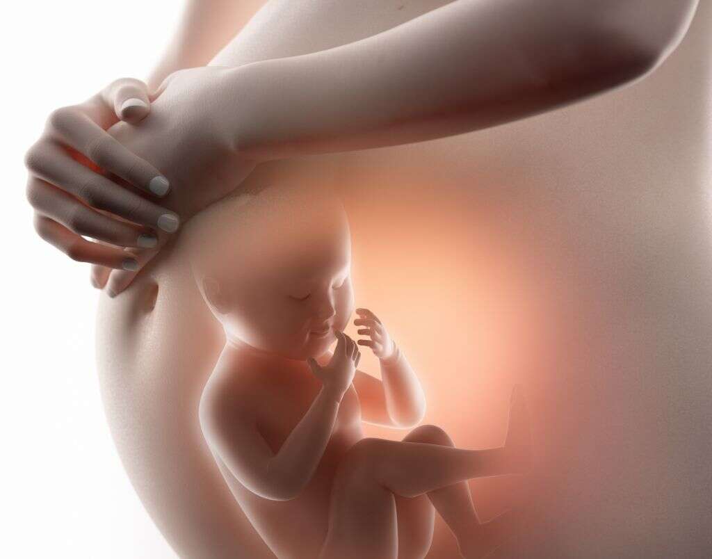 Preeclampsia