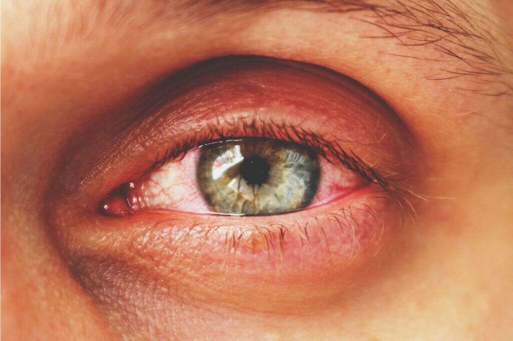 Red Eyes
