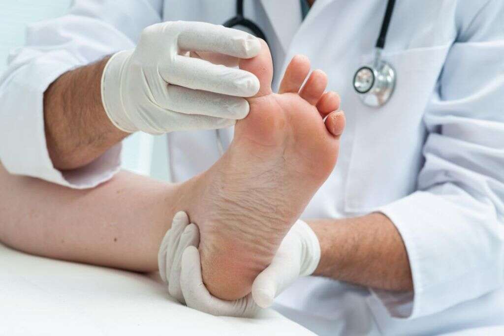 Toenail Fungus
