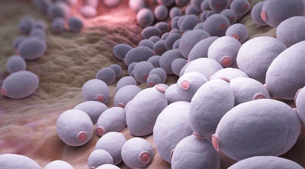 Yeast Infection