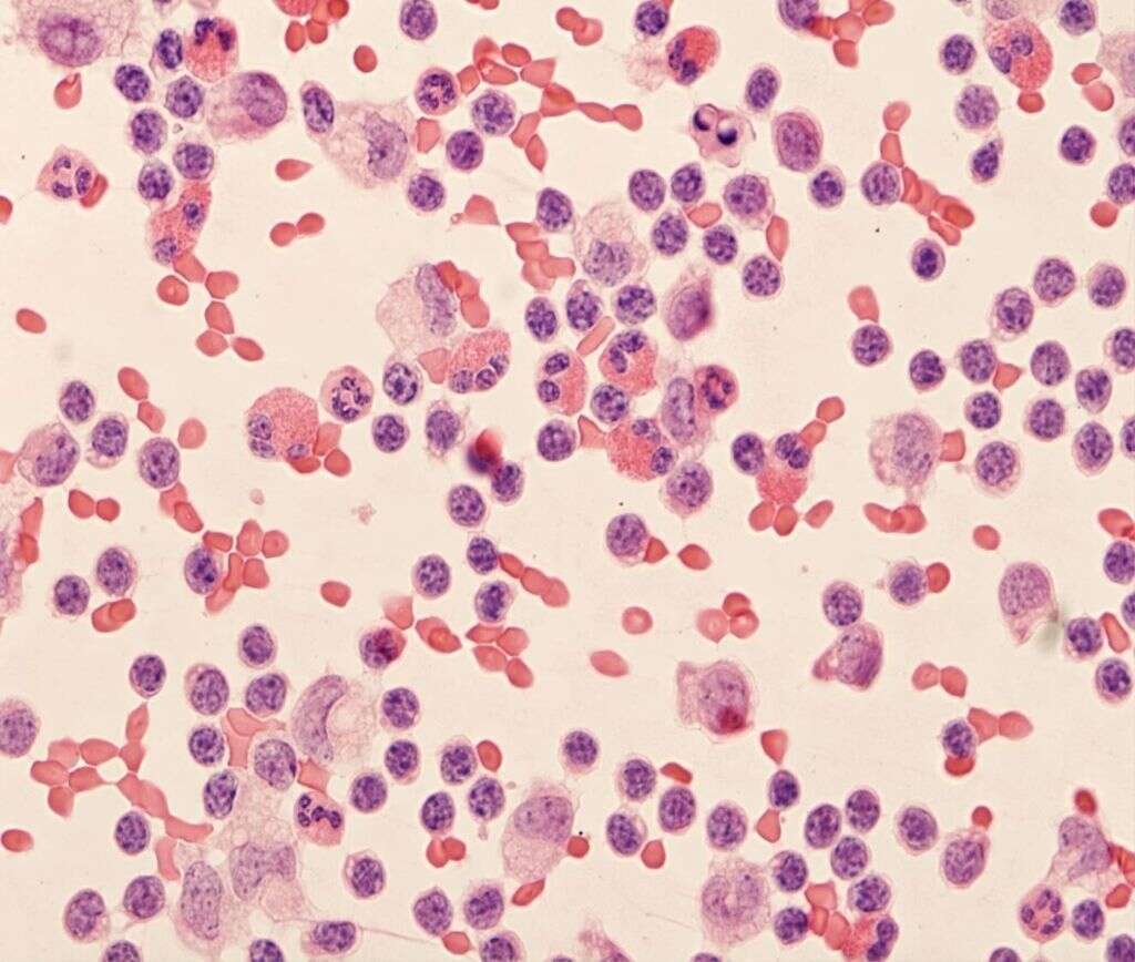 White Blood Cells