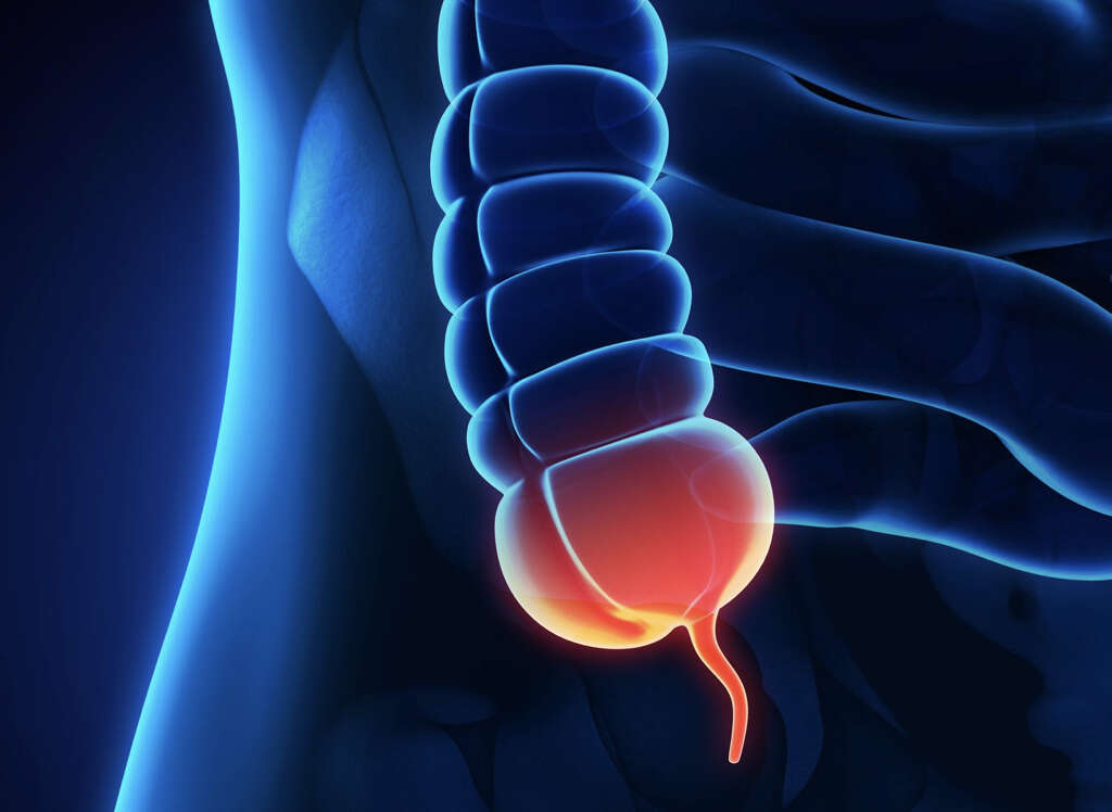 Appendix
