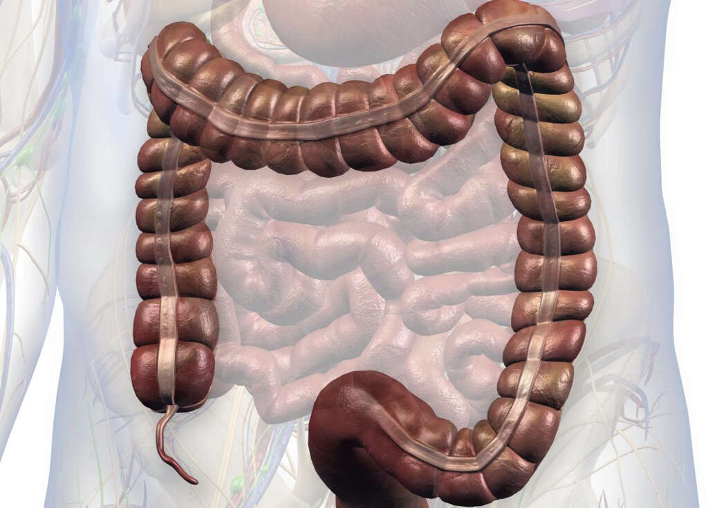 Appendix