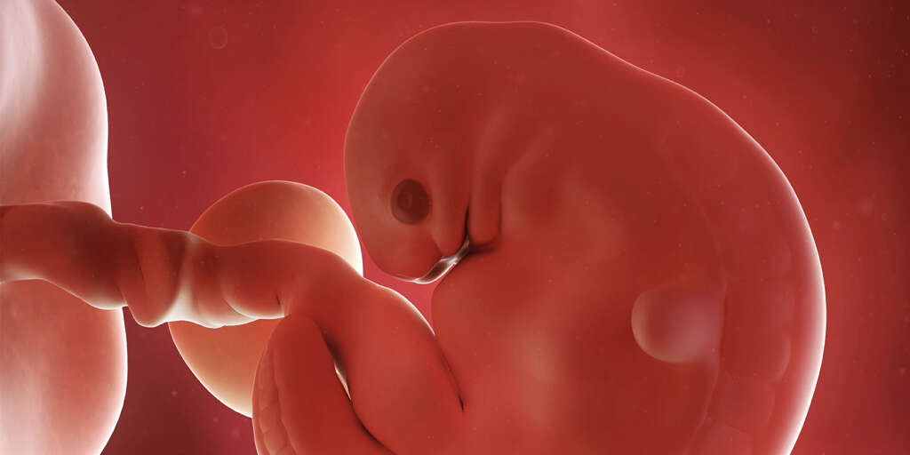 Appendix