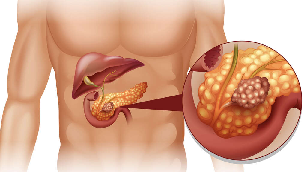Pancreas