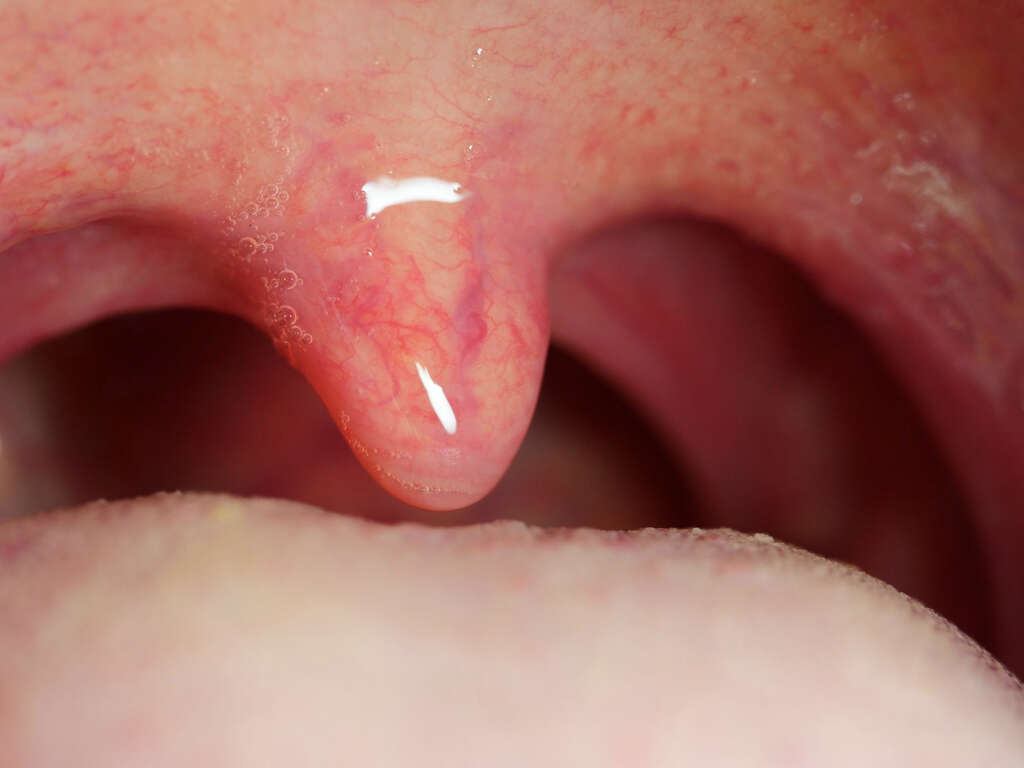 Uvula