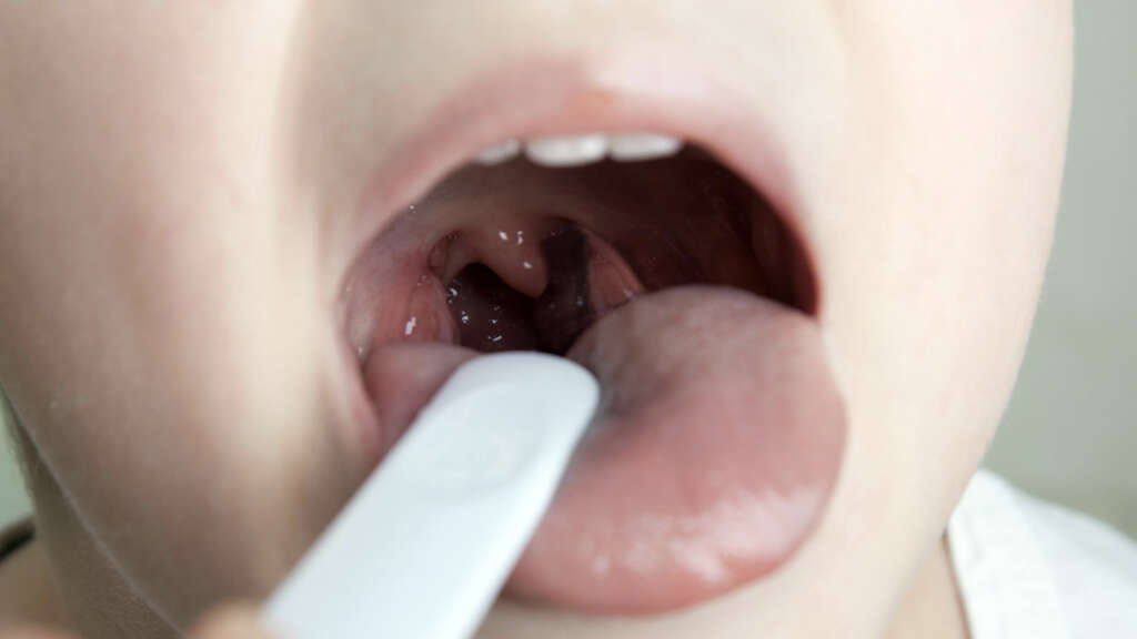 Uvula