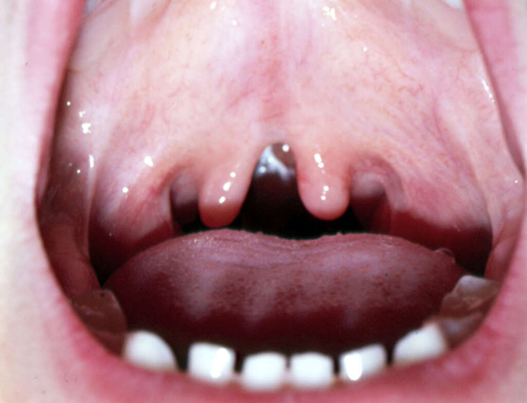 Uvula