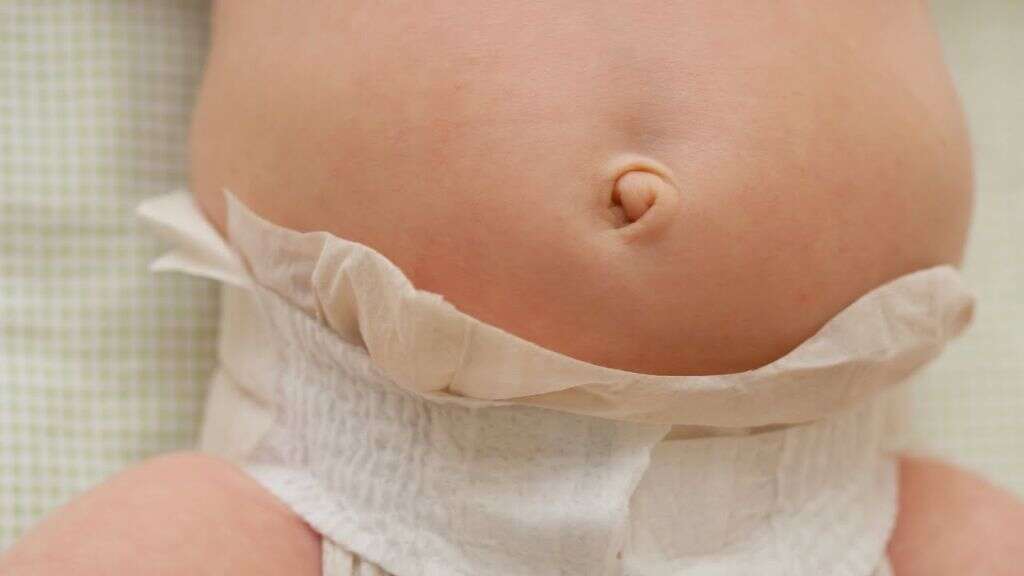 Belly Button Infection