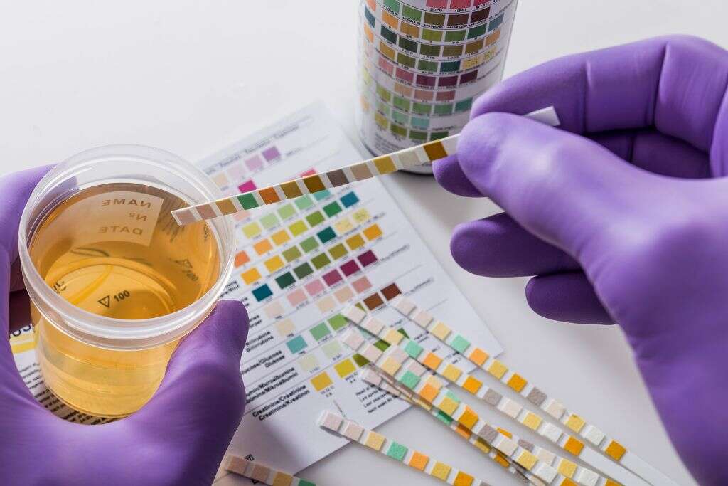 Bladder Infection
