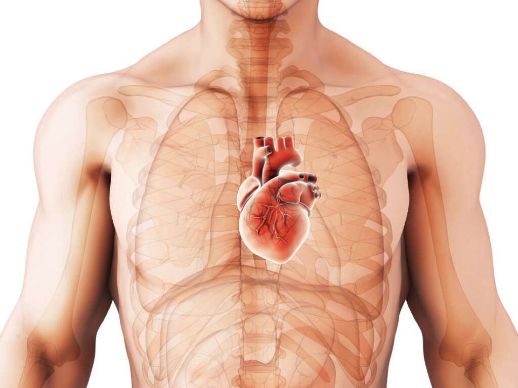 Cardiomegaly