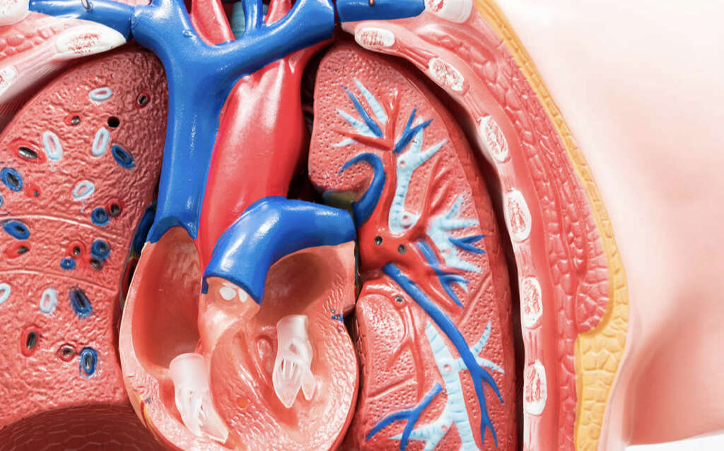 Cardiomegaly