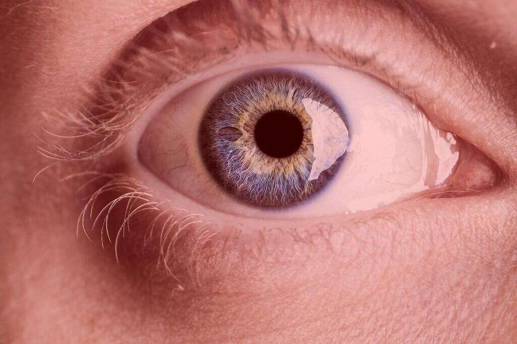 Corneal Ulcer