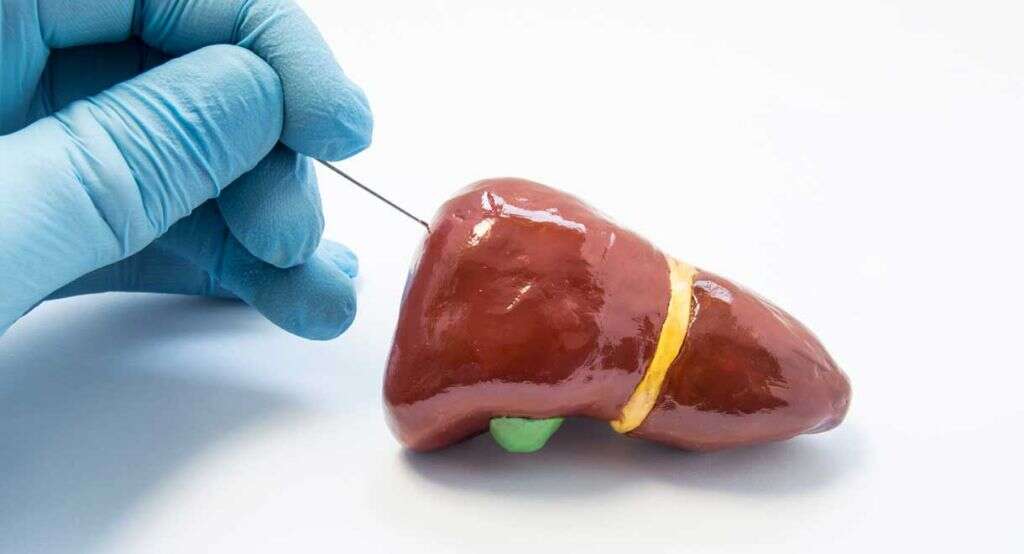 Fatty Liver