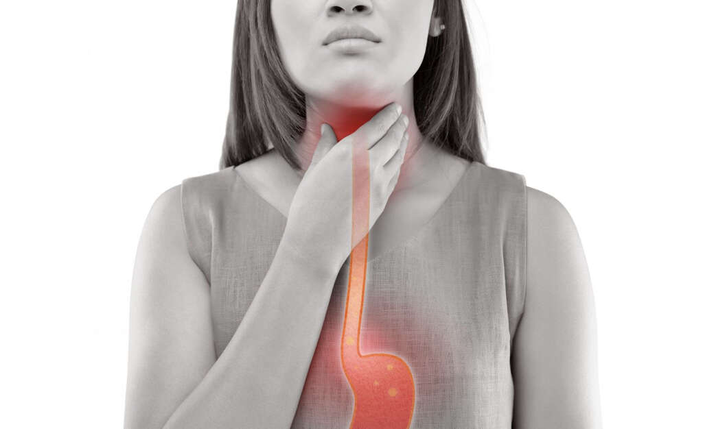 Hiatal Hernia