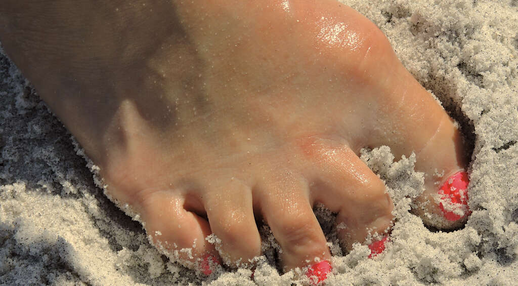 Hookworm Infection