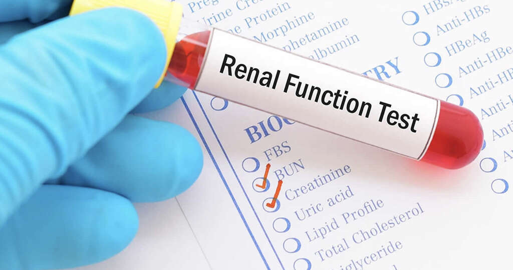 Kidney Cyst