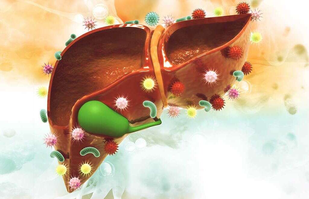 Liver Cyst