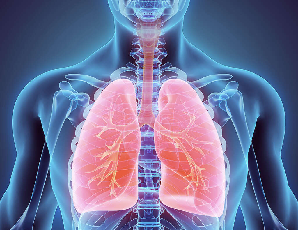 Lung Nodule