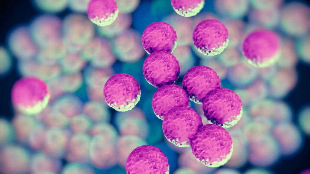 MRSA Infection