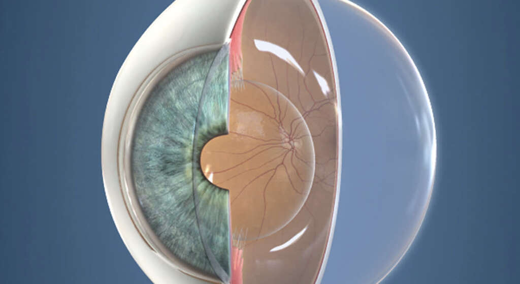 Posterior Vitreous Detachment
