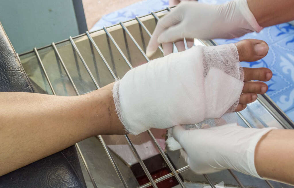 Sepsis Infection