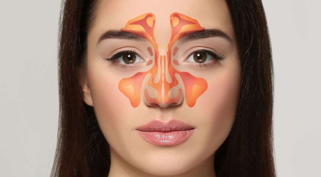 Sinus Infection