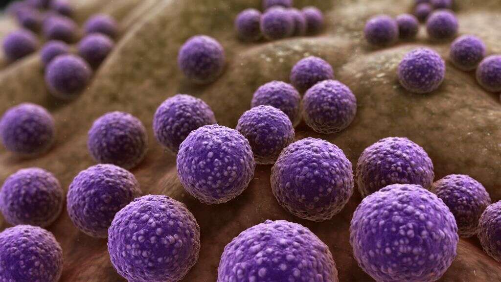 Staph Infection