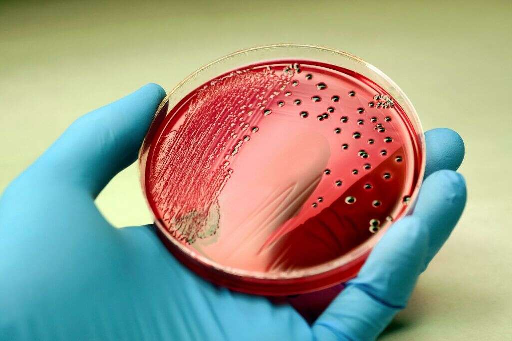 Staph Infection