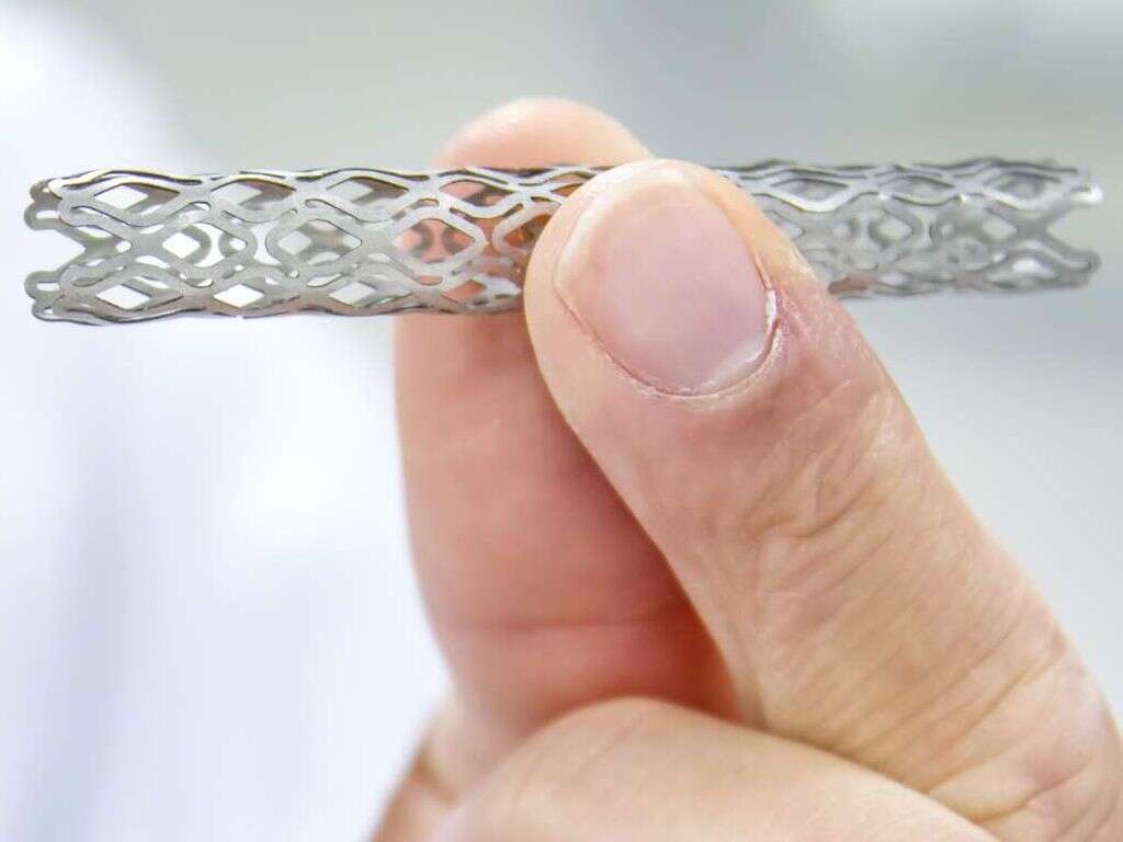 Stent