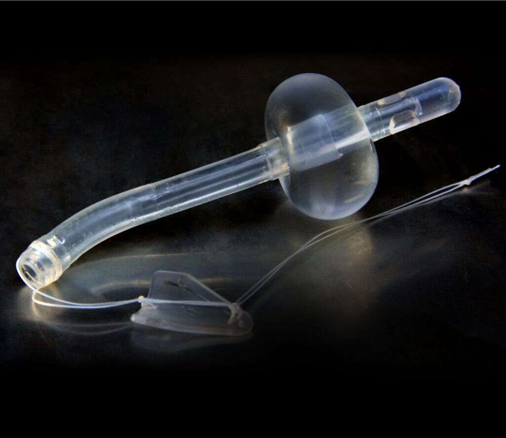 Stent