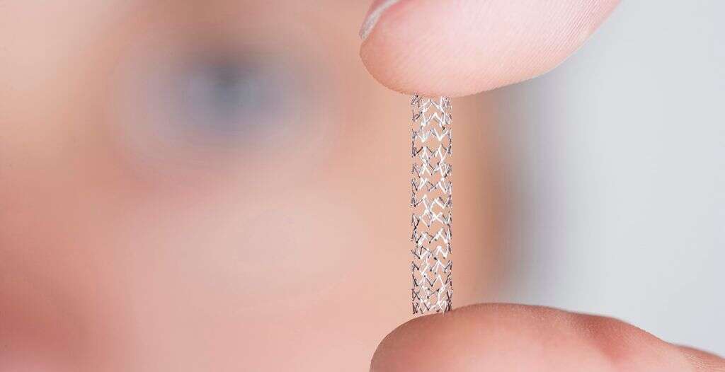 Stent
