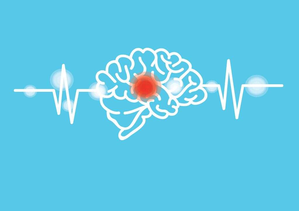 Subarachnoid Hemorrhage