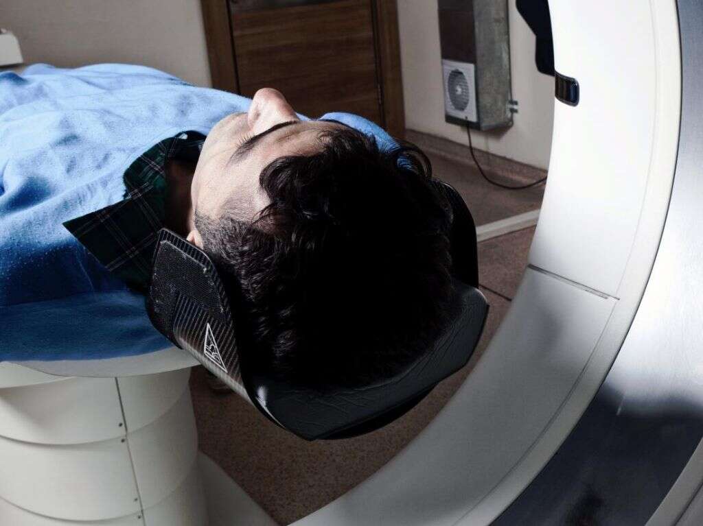 Subarachnoid Hemorrhage