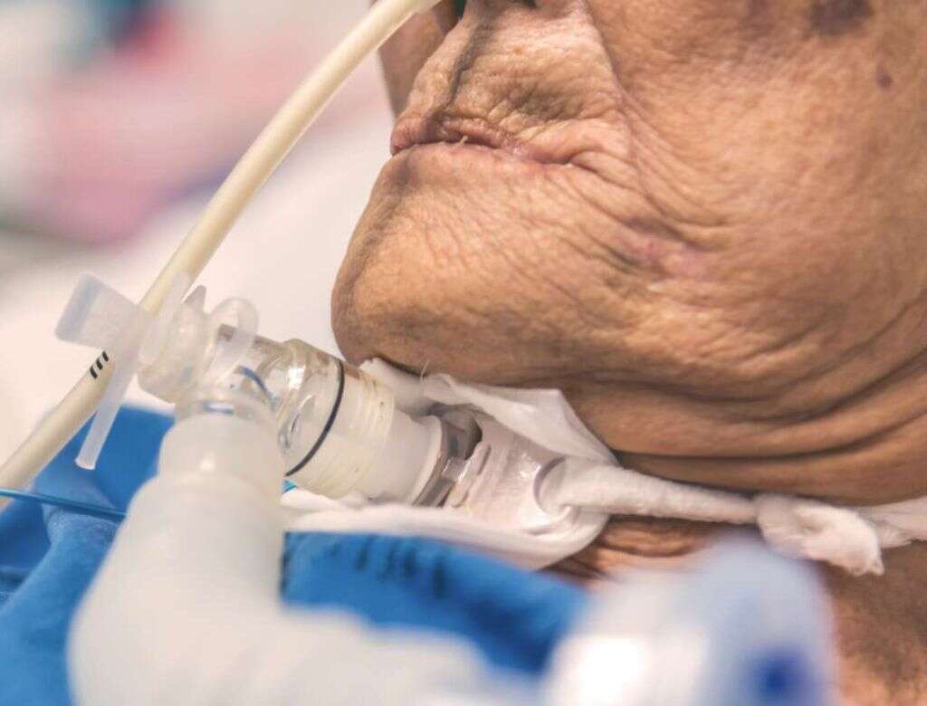 Tracheostomy