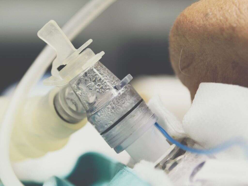 Tracheostomy