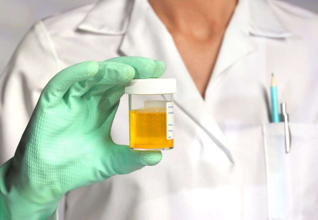 Urinary Tract Infection
