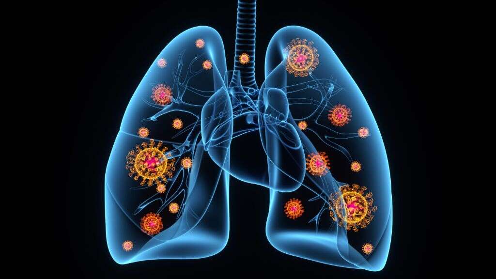 Viral Infection